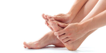plantar fasciitis