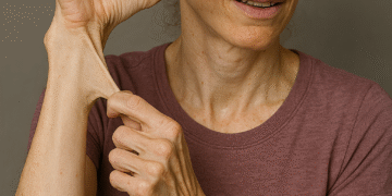 ehlers-danlos syndrome
